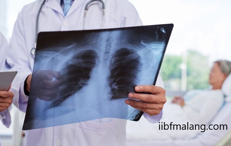 Jurusan Radiologi: Menembus Tubuh